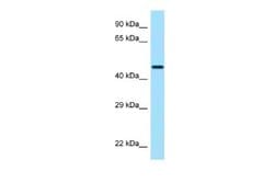 CRHR2/CRF2 Rabbit anti-Human, Polyclonal, Novus Biologicals 0.1ml; Unconjugated:Antibodies,
